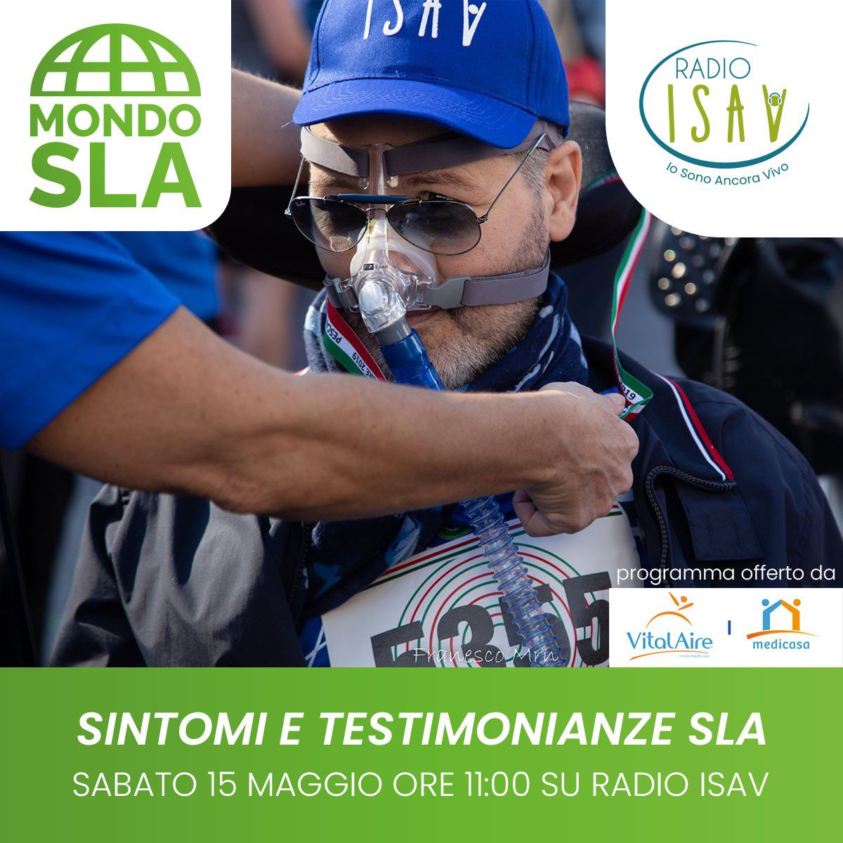 Mondo SLA - I SINTOMI DELLA SLA - puntata del 15 maggio